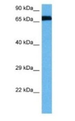 alpha-N-acetylglucosaminidase/NAGLU Rabbit anti-Human, Polyclonal, Novus